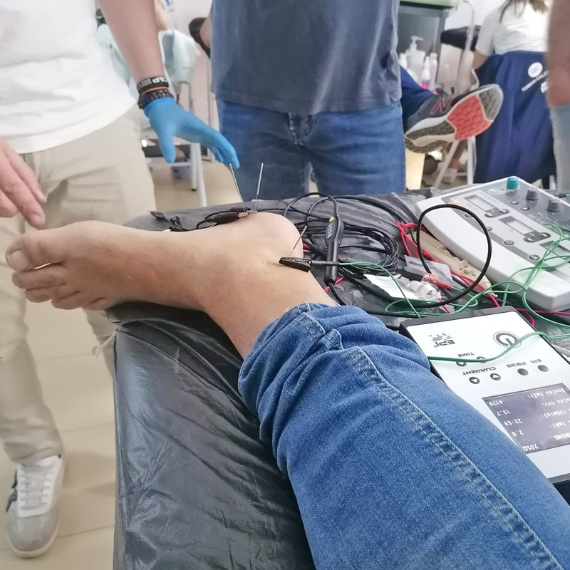 Equipo de electrólisis percutánea en uso
